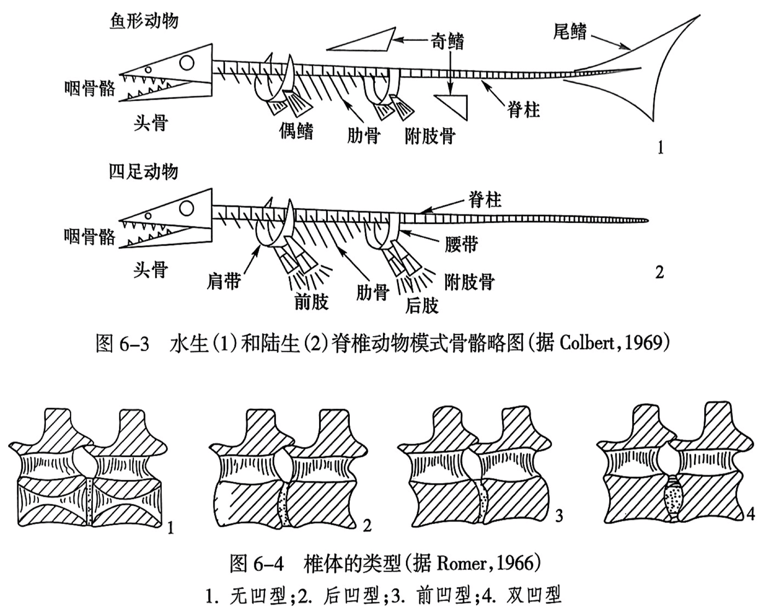 1.无凹型；2.后凹型；3.前凹型；4.双凹型